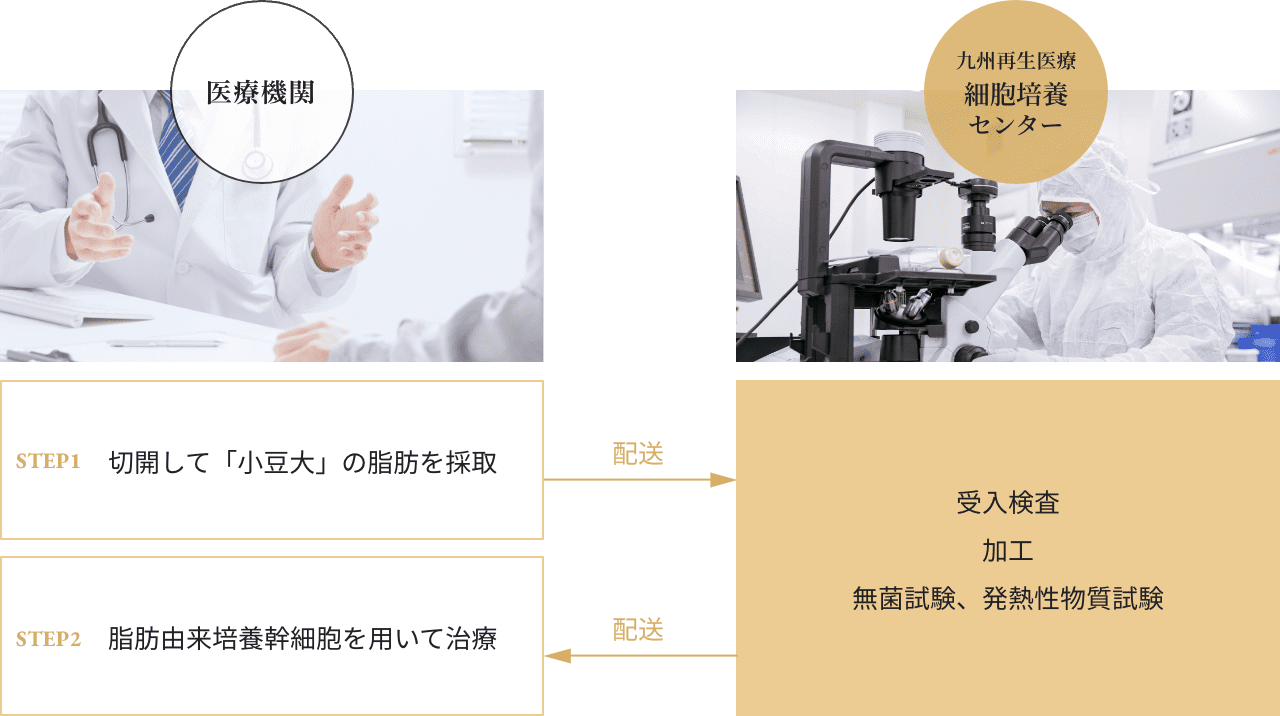 脂肪由来幹細胞加工受託サービスの流れ