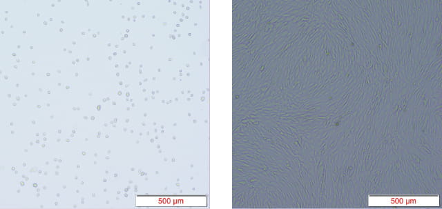 培養した細胞の拡大画像
